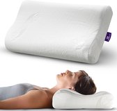 Slaapspeciaal Aloe Vera Nekkussen – Traagschuim Hoofdkussen met Neksteun | 60x40x14/12 cm – Ergonomisch Kussen voor Zij- en Rugslapers – Afritsbare & Wasbare Aloe Vera Hoes – Anti-Allergisch – Memory Foam