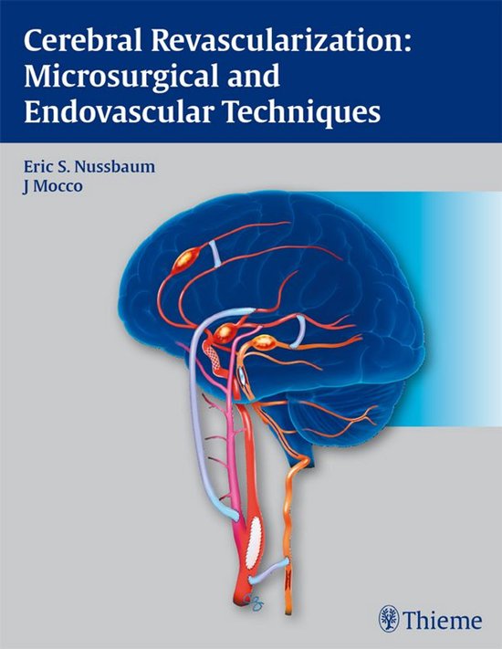 Cerebral Revascularization: Microsurgical and Endovascular T ... - cover