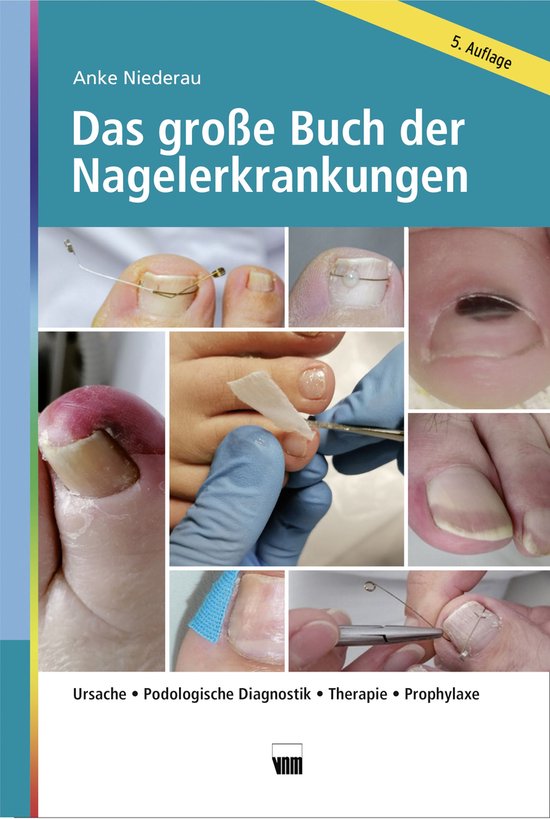 Das große Buch der Nagelerkrankungen - cover