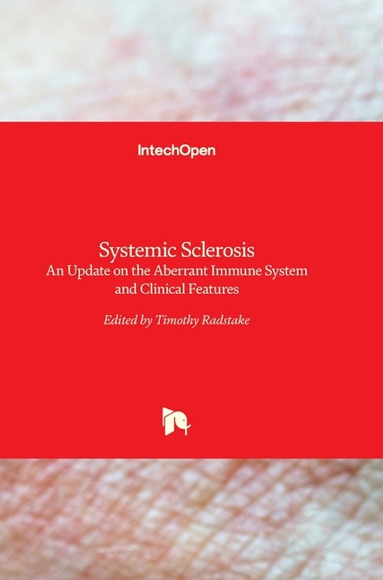 Systemic Sclerosis | 9789533078694 | Boeken | bol