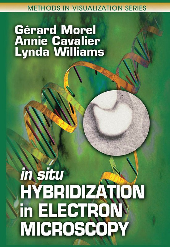 Foto: In situ hybridization in electron microscopy
