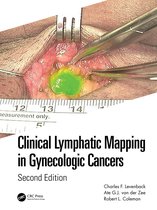 Clinical Lymphatic Mapping in Gynecologic Cancers