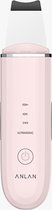 ANLAN Skin Scrubber Utrasound Ultrasone Huid Scrubber - Huid Scrubber Elektrisch - Ultrasone Gezichtsreiniger Poriën Reinigingsmachine ALCPJ07-04 (roze)