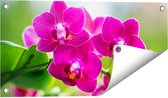 Gards Tuinposter Roze Orchidee Bloemen - 60x30 cm - Tuindoek - Tuindecoratie - Wanddecoratie buiten - Tuinschilderij