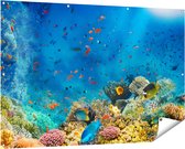 Gards Tuinposter Onderwater Vissen met Koraal in de Zee - 150x100 cm - Tuindoek - Tuindecoratie - Wanddecoratie buiten - Tuinschilderij