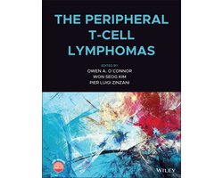 The Peripheral T-Cell Lymphomas
