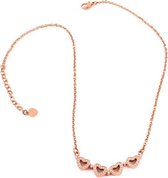 Ketting Dames Folli Follie 3N1T033RS (30 cm)