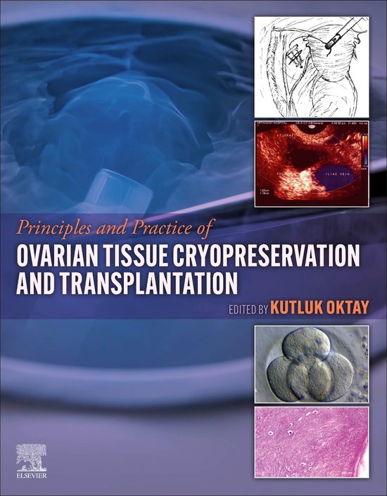 Principles and Practice of Ovarian Tissue Cryopreservation a ... - cover