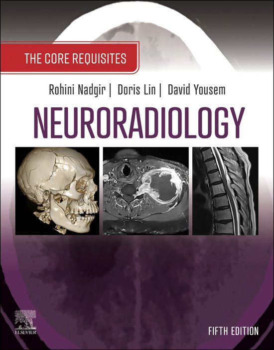 The Core Requisites - Neuroradiology: The Requisites E-Book