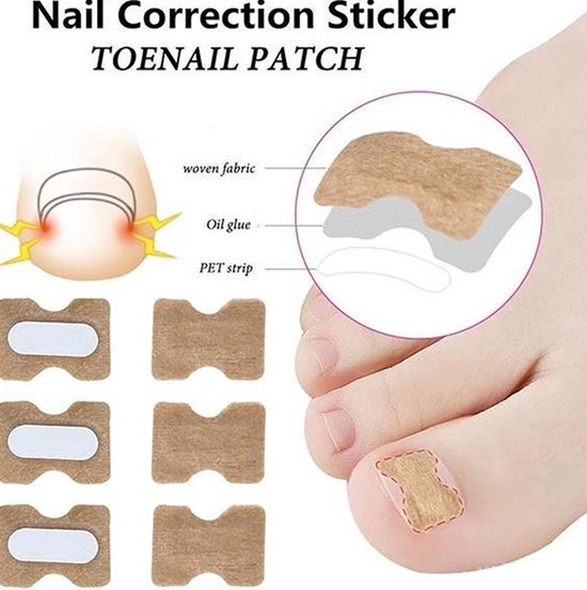 Goedkoopste Teennagel Lifter Pleisters 30 Stuk I Ingegroeide Teennagel Corrector I Teennagel I Anti Ingroei Pleister I Nagel Correctie Kit