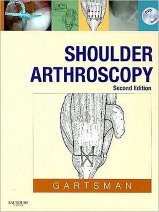 Shoulder Arthroscopy - cover