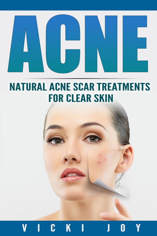 ACNE - cover