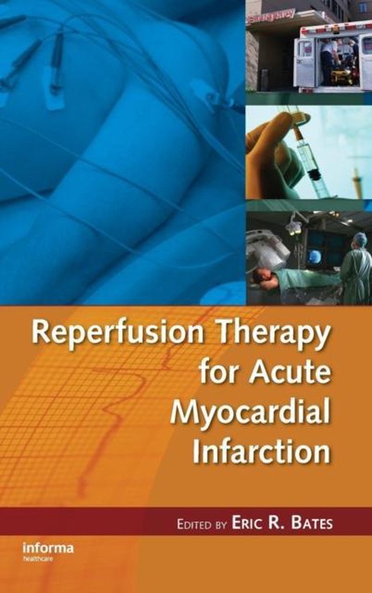 Reperfusion Therapy for Acute Myocardial Infarction | 9780849343582 ...