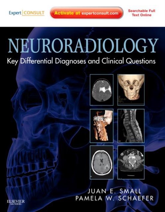 Neuroradiology Key Differential Diagnoses and Clinical Questions