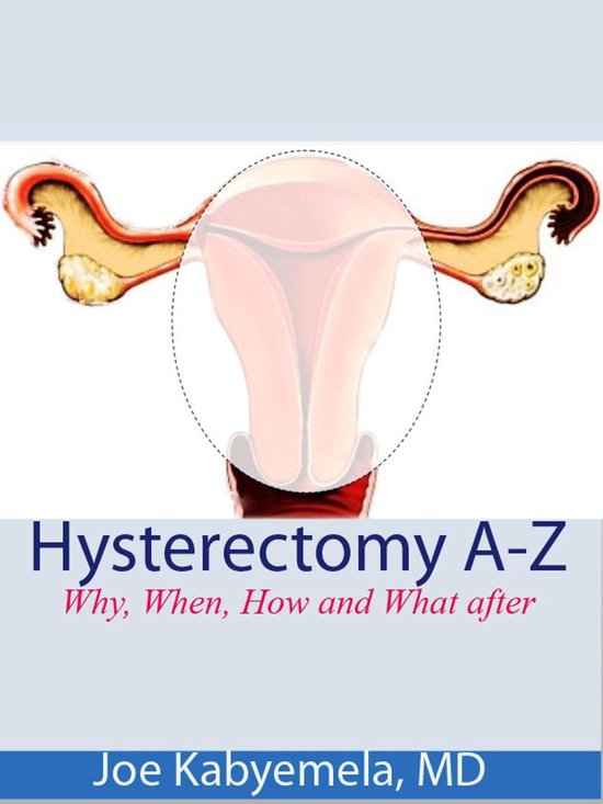 Hysterectomy A-Z: Why, When, How and What after - cover