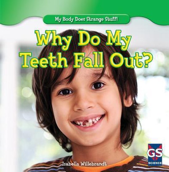 Why Do My Teeth Fall Out? 9781482402995 Isabella Willebrandt Boeken