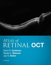 Atlas of Retinal OCT E-Book