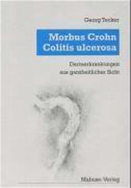 Morbus Crohn, Colitis Ulcerosa. Darmerkrankungen aus ganzheitlicher Sicht