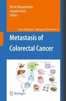 Cancer Metastasis - Biology and Treatment- Metastasis of Colorectal Cancer
