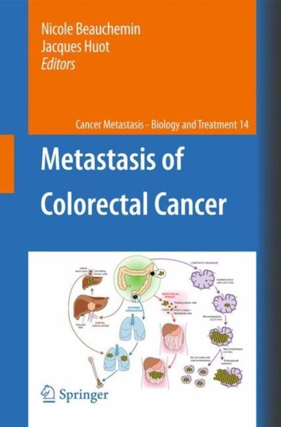 Foto: Cancer metastasis biology and treatment metastasis of colorectal cancer