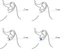 Schematische tekening van oren met oorstekers van 2 mm, 4 mm, 6 mm en 8 mm.