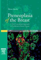 Preneoplasia of the Breast