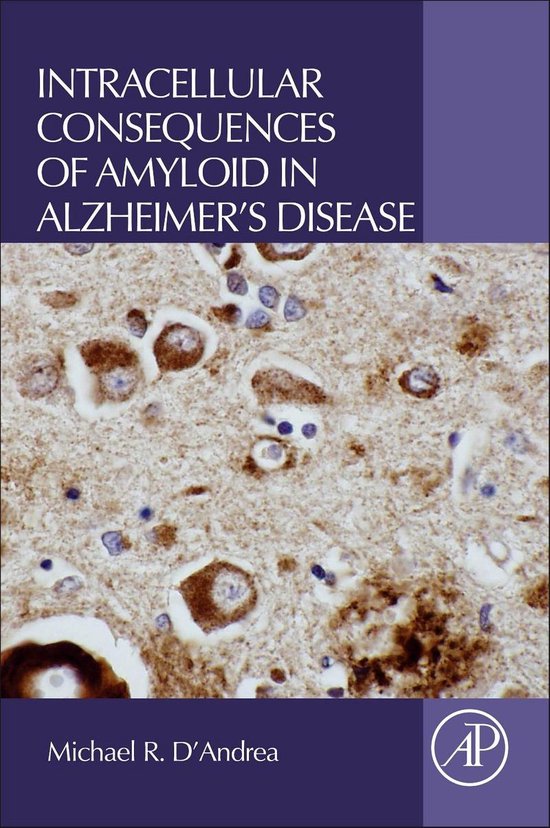 Intracellular Consequences of Amyloid in Alzheimer's Disease - cover