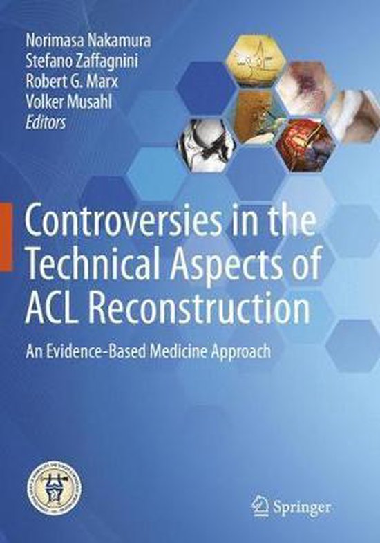 Controversies in the Technical Aspects of ACL Reconstruction - cover