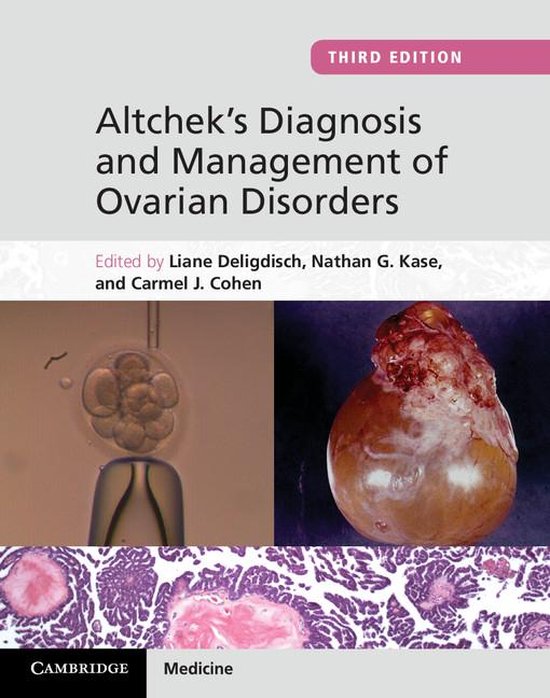 Altchek's Diagnosis and Management of Ovarian Disorders - cover