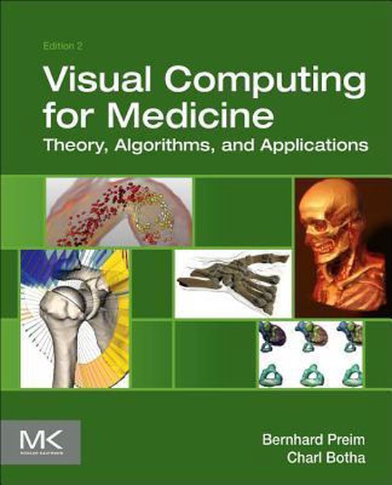 Visual Computing for Medicine | 9780124158733 | Bernhard Preim | Boeken ...