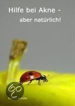 Hilfe Bei Akne - Aber Nat Rlich!