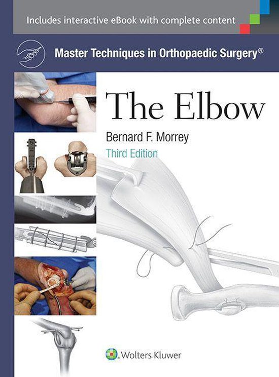 Master Techniques in Orthopaedic Surgery - Master Techniques ... - cover