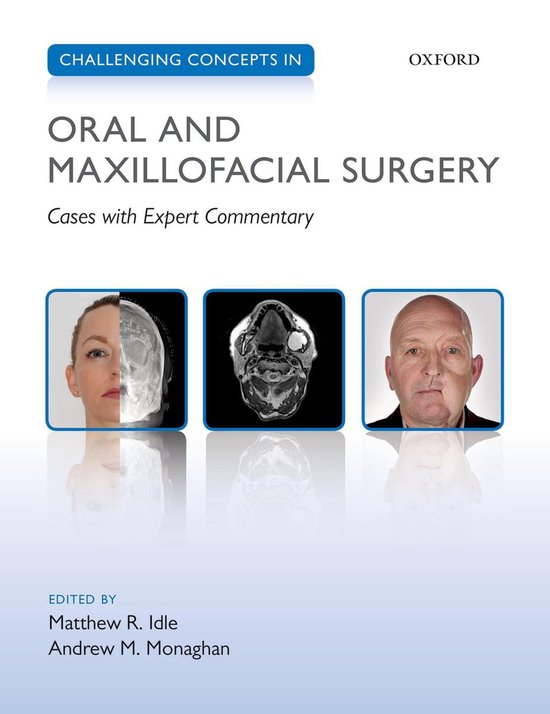 Challenging Cases - Challenging Concepts in Oral and Maxillo ... - cover