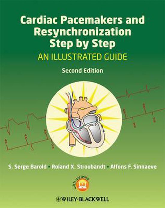 Foto: Cardiac pacemakers resynchronization