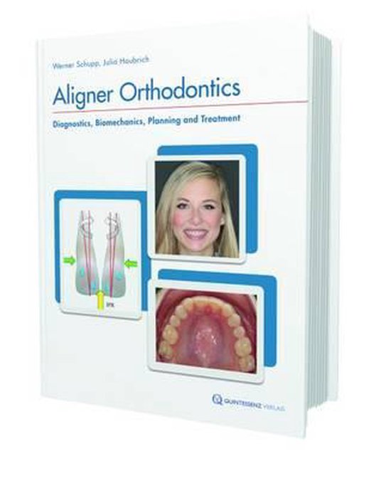 Aligner Orthodontics Diagnostics, Biomechanics, Planning, and Treatment bol