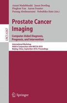 Prostate Cancer Imaging: Computer-Aided Diagnosis, Prognosis, and Intervention