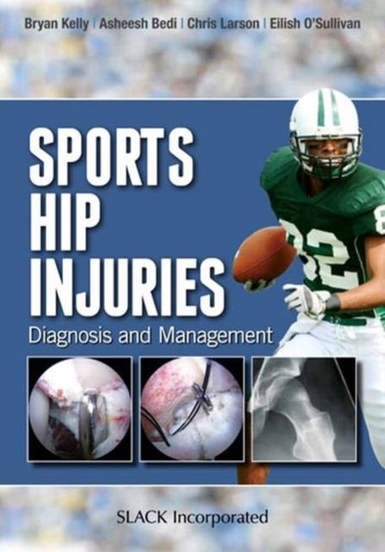Sports Hip Injuries 9781617110467 Bryan Kelly Boeken