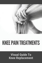 Knee Pain Treatments: Visual Guide To Knee Replacement