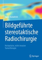 Bildgeführte stereotaktische Radiochirurgie