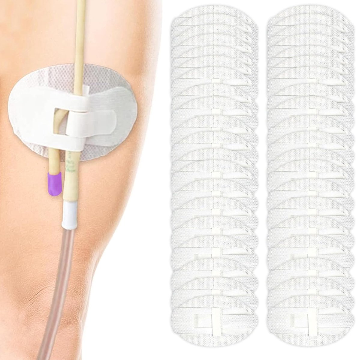 40 stuks katheter-stabilisatieapparaat, urinaire beentas, beenriem, stickers, statlock foley katheter houder, zelfklevende katheter benodigdheden voor enkele / dubbele buis, G tube en voerbuis op