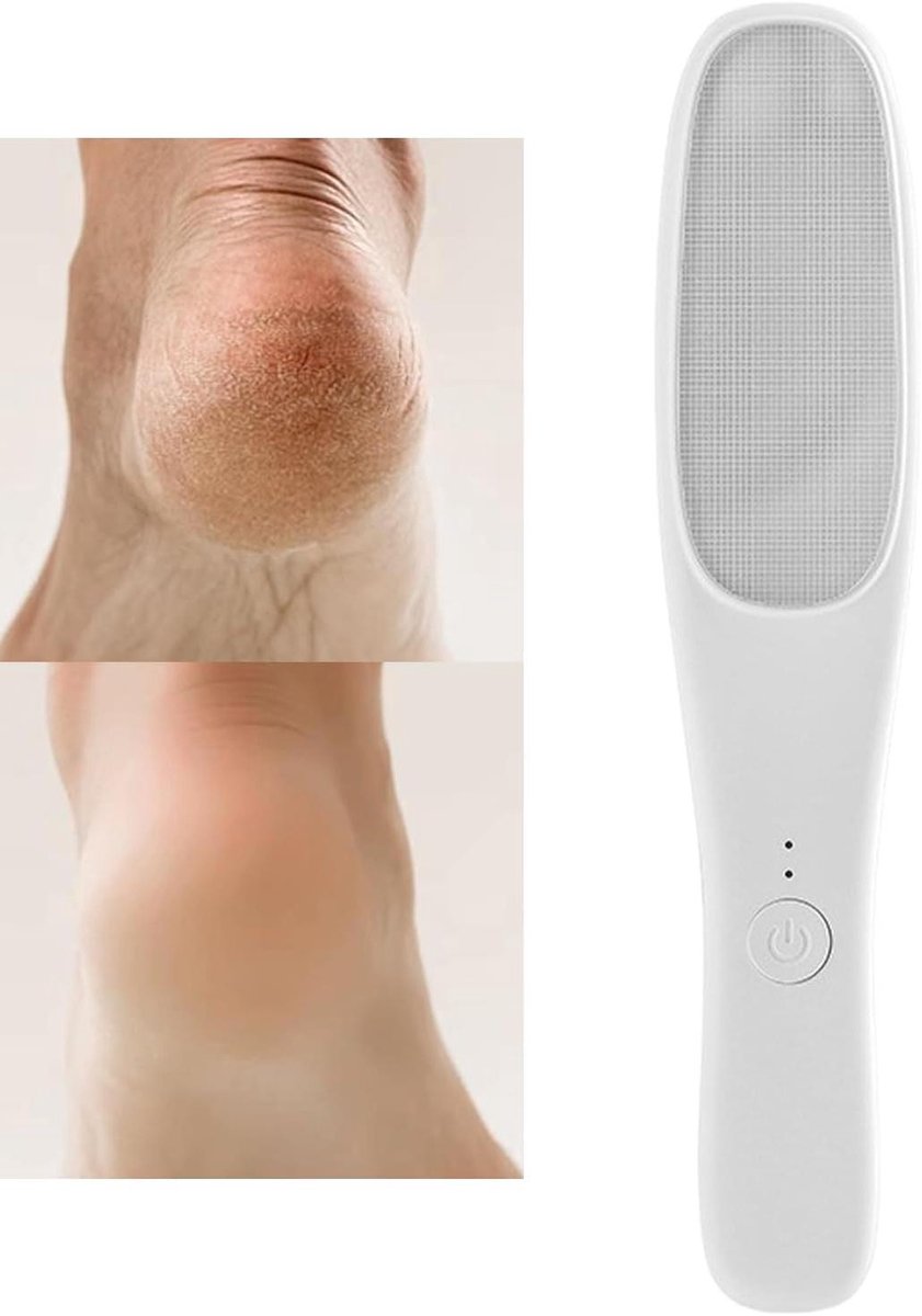 Elektrische Voetverzorger - Pedicure Set - Voeten Zacht Maken - Zes Snelheden - 17.5 cm - Wit
