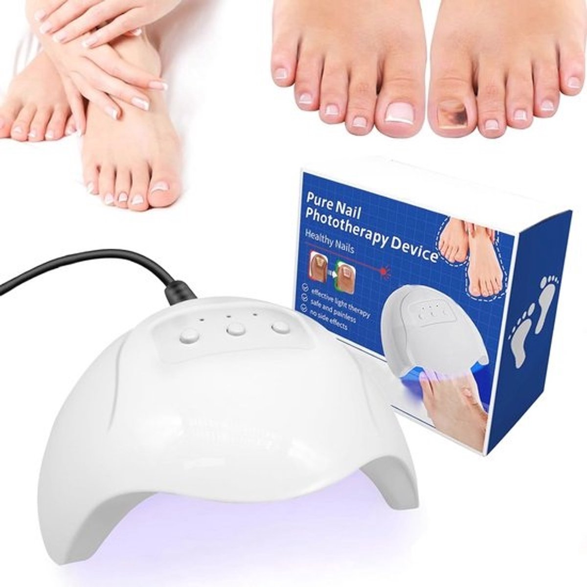 Effectieve Lichttherapie tegen Nagelschimmel voor Gezonde Nagels