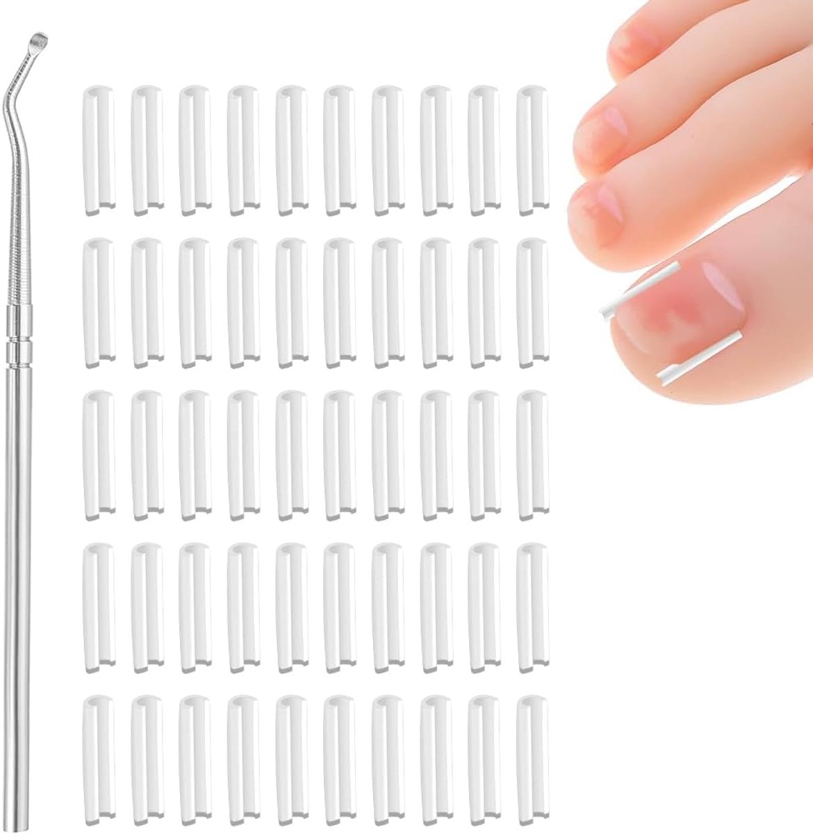 Thijox - Set met gecamoufleerde nagels en lifter voor ingegroeide teennagels, correctieroller en accessoires voor effectieve nagelverzorging en pijnve
