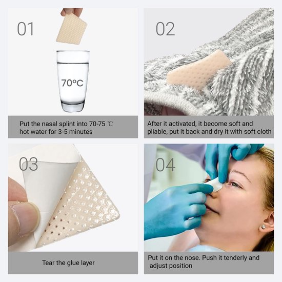 neusspalken - Neus externe ondersteuning beschermer voor neus brace breuk, rinopla-sty Septopla-sty, ENT, Orthop-edische Immob-ilization, 5 STKS (M) — afbeelding 4