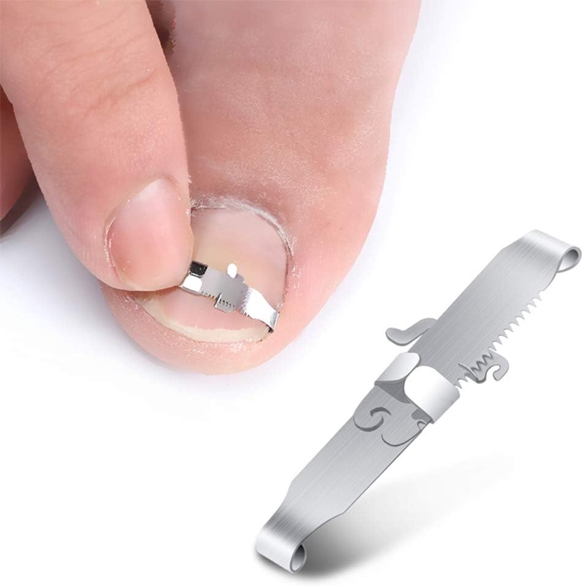 2-Delig Ingegroeide Teennagelhulpmiddelen, Ingegroeide Teennagel Correctiegesp en Teennagelheffer voor Ingegroeide Teennagels en Paronychia-Behandeling - Chirurgisch Roestvrij Staal - Met Opbergdoos van Tin