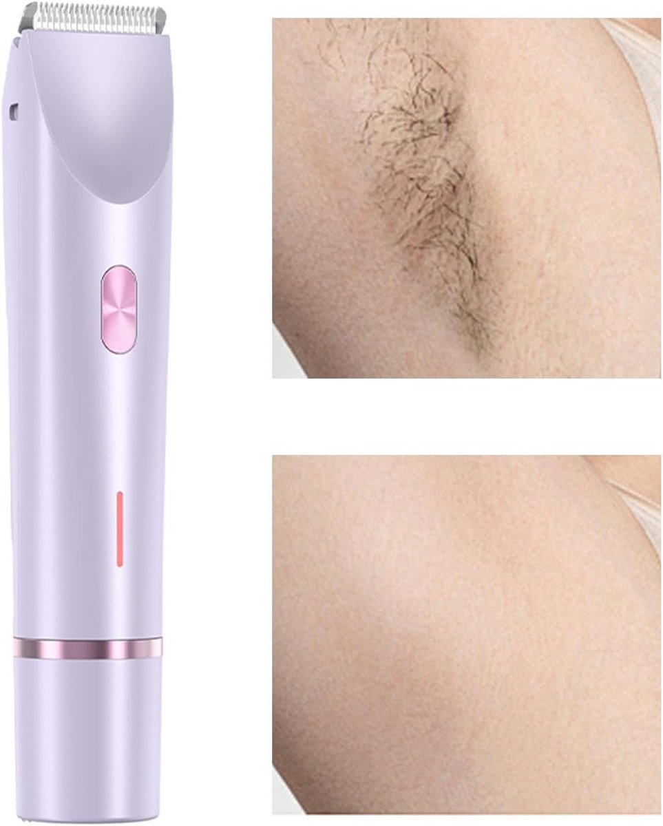 Trimmer voor het gezicht voor dames, trimmer voor dames – krachtige ontharingsapparaat of droog ontharingsapparaat voor het hele lichaam