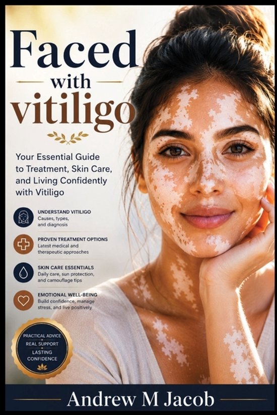 Faced with vitiligo - cover