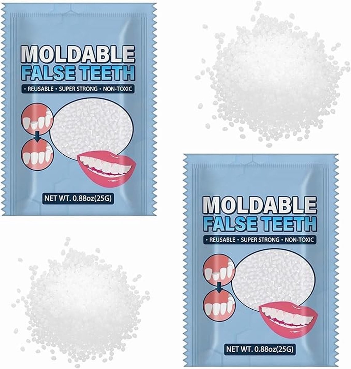 Solidchoice - Tijdelijke Tandheelkundige Reparatieset