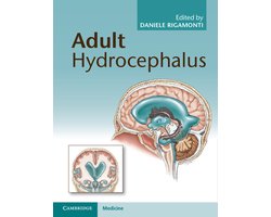 Adult Hydrocephalus