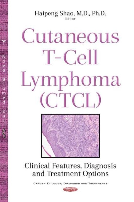 Cutaneous T-Cell Lymphoma (CTCL)